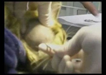 Kedide Yüz Apsesine Müdahale