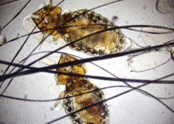 Koyunların Yapağı Yeme – Mallophaga Hastalığı