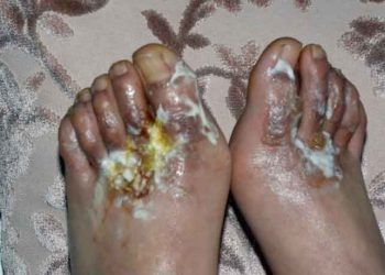 Hayvancılığın Devamı Olan, Deri Sanayinde de İzlenebilirlik Kaçınılmaz