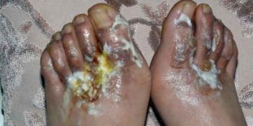 Hayvancılığın Devamı Olan, Deri Sanayinde de İzlenebilirlik Kaçınılmaz