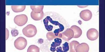 Schalm's Veteriner Hematolojisi