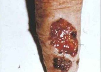 Yalancı Sığır Çiçeği