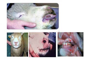 Mavi Dil Hastalığı