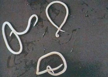 Buzağılarda Ascariasis