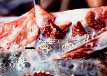 Verminöz Pneumoni (Paraziter Bronkopnömoni)