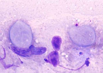 Buzağılarda Giardiasis