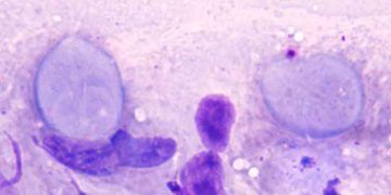 Buzağılarda Giardiasis