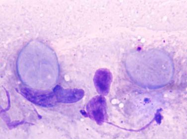 Buzağılarda Giardiasis