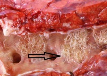 Koyunlarda Verminöz Pneumoni (Paraziter Bronkopnömoni)