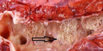 Koyunlarda Verminöz Pneumoni (Paraziter Bronkopnömoni)