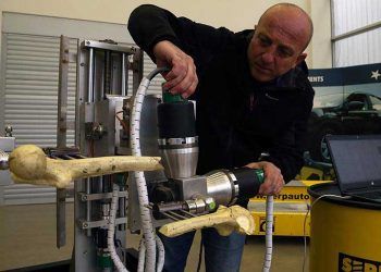 Roborto ile ameliyatlarda başarının yükseltilmesi hedefleniyor