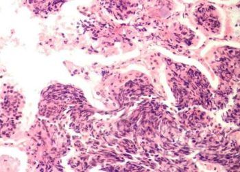 Yulaf Biçimli Hücreler Nedir?