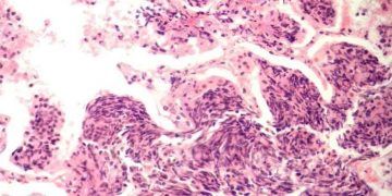 Yulaf Biçimli Hücreler Nedir?