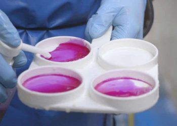 California Mastitis Test 'in Uygulanışı (CMT)