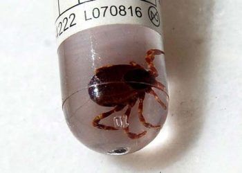 Sivas'ta KKKA hastalığı şüphesiyle ölüm