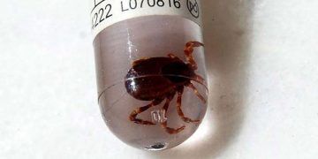 Sivas'ta KKKA hastalığı şüphesiyle ölüm