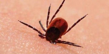 Kırım Kongo Kanamalı Ateşi (KKKA)