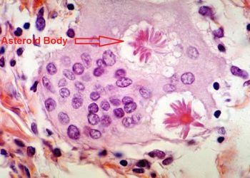 Yıldızsı Cisimcik Nedir?