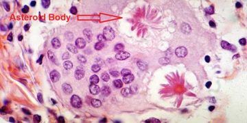 Yıldızsı Cisimcik Nedir?