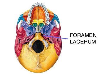 Yırtık Delik Nedir?