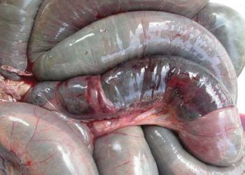 Hemorajik Bağırsak Sendromu Nedir?