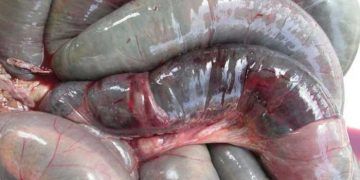 Hemorajik Bağırsak Sendromu Nedir?