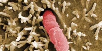 Psödotüberküloz Nedir?