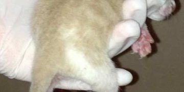 Yetersiz Kallus Nedir?