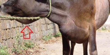 Çene Altında Şişlik