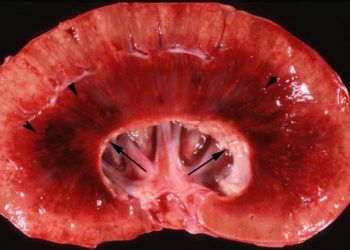 ineklerde Böbrek Yangısı