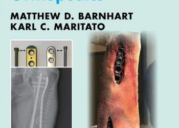 Veteriner Ortopedide Kilitli Plakalar