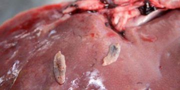 Fasciola Hepatica (Yaprak kelebeği)