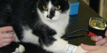 Yerel Amiloidozis Nedir?