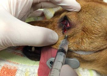 Yerel Anestezi Nedir?