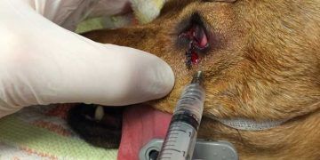 Yerel Anestezi Nedir?