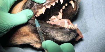 Yerel Anestezik Nedir?