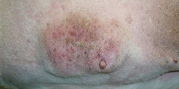 Dişi Köpekte Meme Tümörü