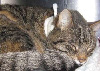 Yemek Borusu Spazmı Nedir?