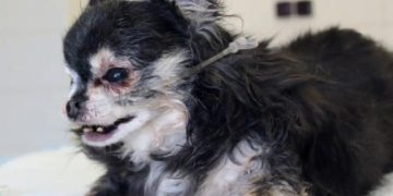 Yemek Borusu Çöküntüsü Nedir?