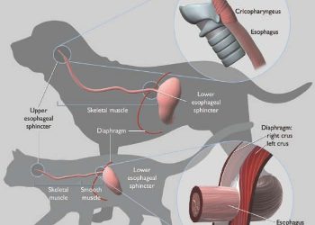 Yemek Borusu Ektazisi Nedir?