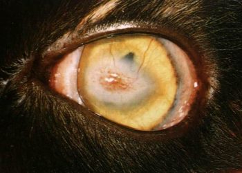 Korneal Opasite Nedir?