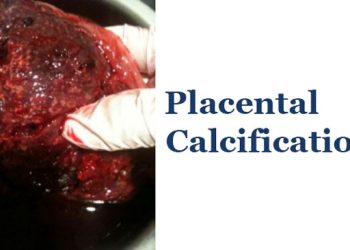 Yavru Zarları Kireçlenmesi Nedir?