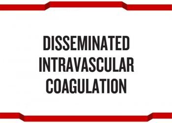 Yaygın Damar İçin Pıhtılaşma Nedir?