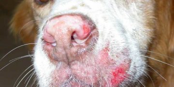 Yaygın Deri Layşmanyozisi Nedir?