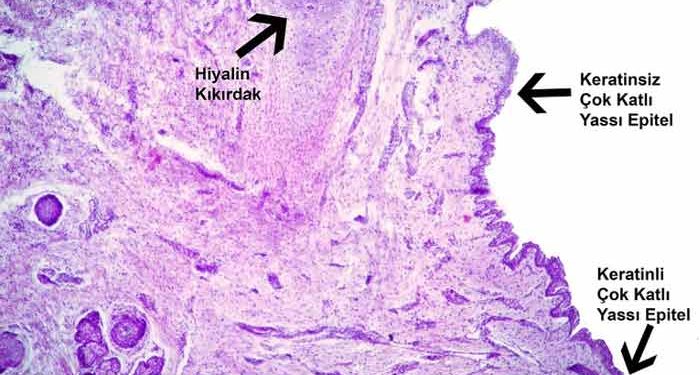 Yassı Alveolar Hücre Nedir?