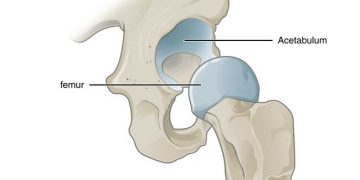 Yarı Oynar Eklem Nedir?