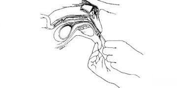 Yapay Tohumlama Nedir?