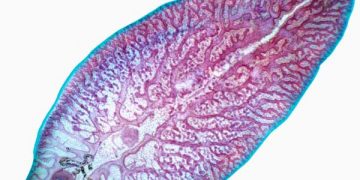 Yaprak Kelebeği Nedir?