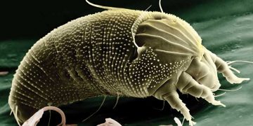 Yara Kabuğu Akarı Nedir?