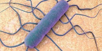 Gıda Kaynaklı Listeria